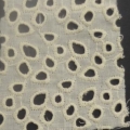 CE1974